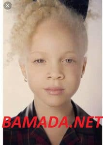 assassinat-ramata-diarra-petite-albinos-tue-gombele-mort-fana-election-presidentielle-africaine-mali-bamako-fana.jpg